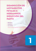 Disminución de movimientos fetales e hidramnios. Inducción del parto