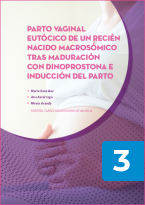 Parto vaginal eutócico de un recién nacido macrosómico tras maduración con dinoprostona e inducción del parto